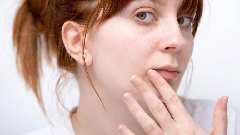 Uçuk deyip geçmeyin, bakın neye sebep oluyor