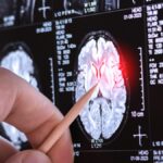 Sadece 13 kişide görüldü!Sağlık Haberleri