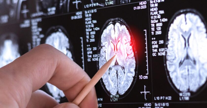 Sadece 13 kişide görüldü!Sağlık Haberleri